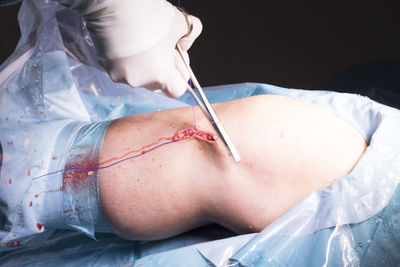 Cropped hands of surgeon performing surgery on patient