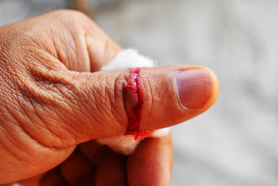 Close-up of cropped man showing bleeding thumb