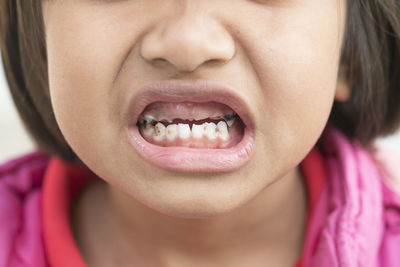 Close-up of a girl