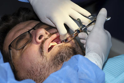 A man with a slight beard undergoing a dental procedure