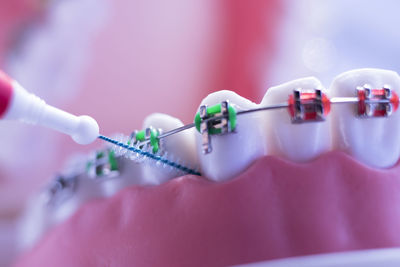 Close-up of dental equipment