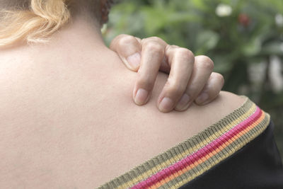 Cropped image of woman scratching shoulder
