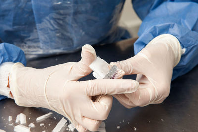 Scientist preparing paraffin blocks containing biopsy tissue for sectioning. pathology laboratory. 