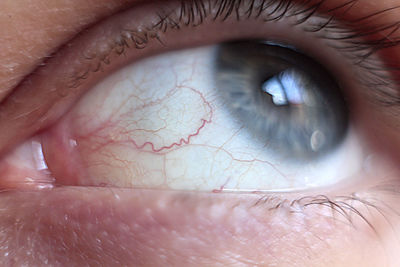 Close-up of human eye