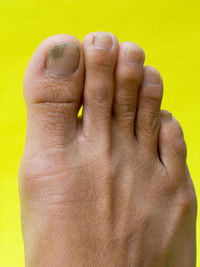 Cropped image of foot against yellow background