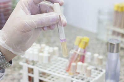 Cropped hand of scientist holding dental equipment