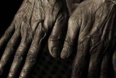 Close-up of senior person showing wrinkles on hand