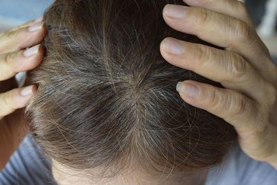 High angle view of woman showing scalp