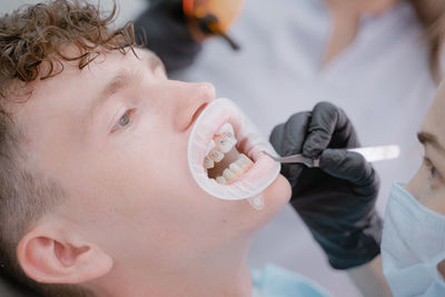 An orthodontist glues braces to the teeth of a young guy, there are braces on the upper dentition