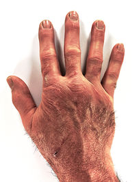 finger