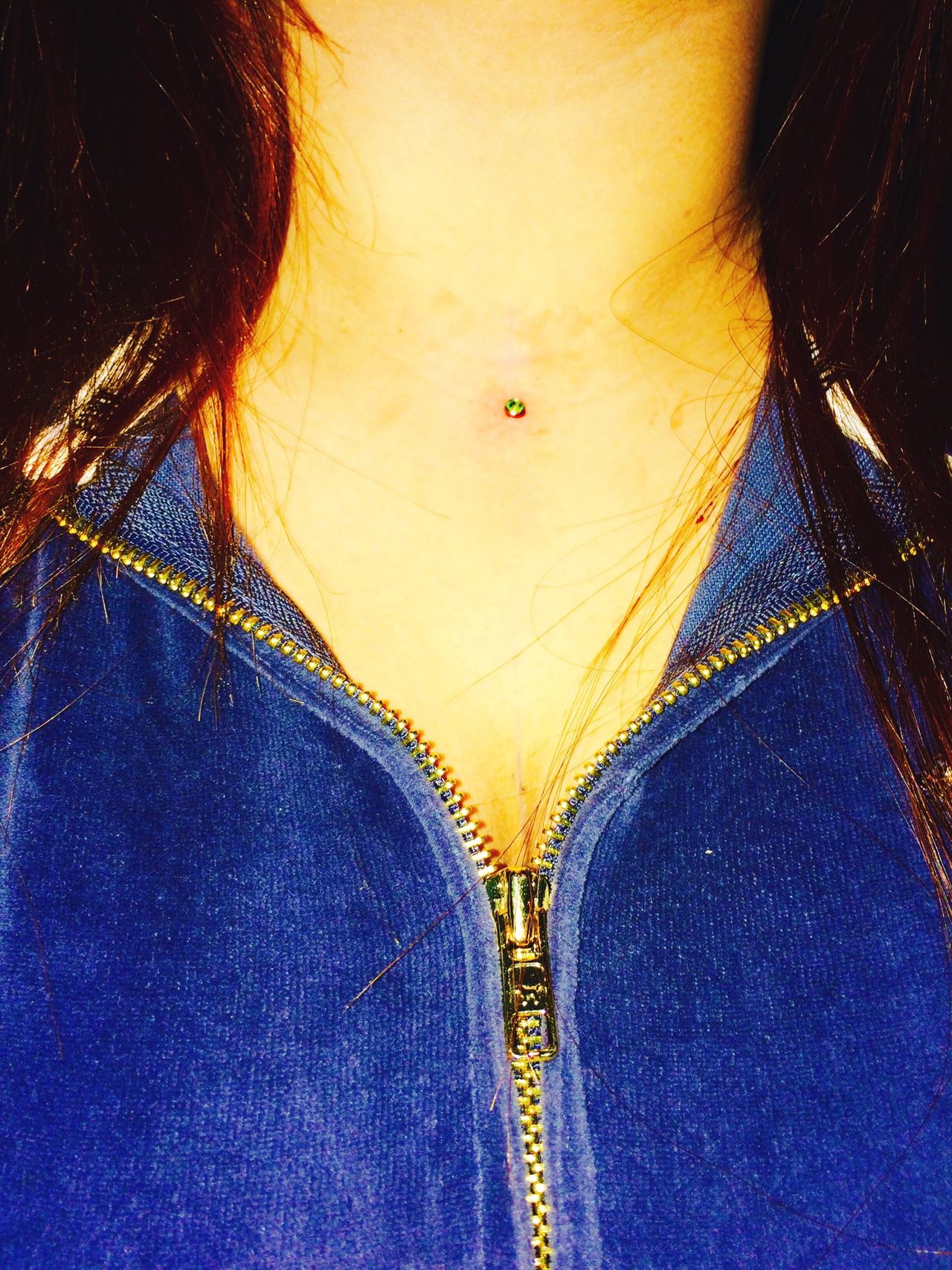 ChestDermal