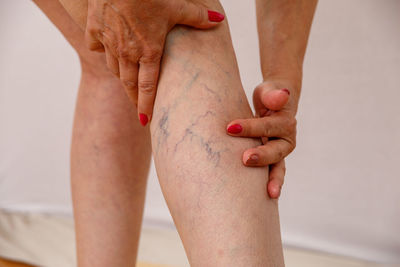Midsection of woman touching veins of leg
