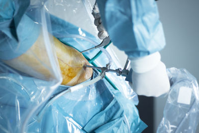 Cropped hand of surgeon operating patient at hospital