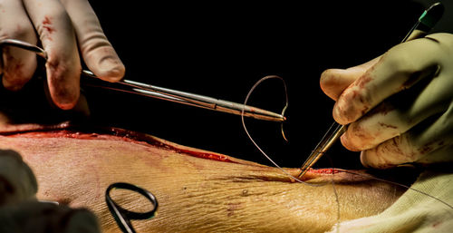 Cropped hands of doctor stitching human skin