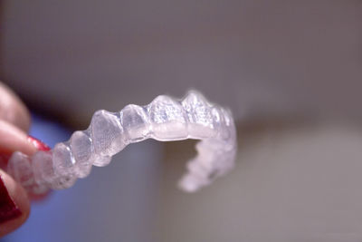 Cropped hand of woman holding dental aligner