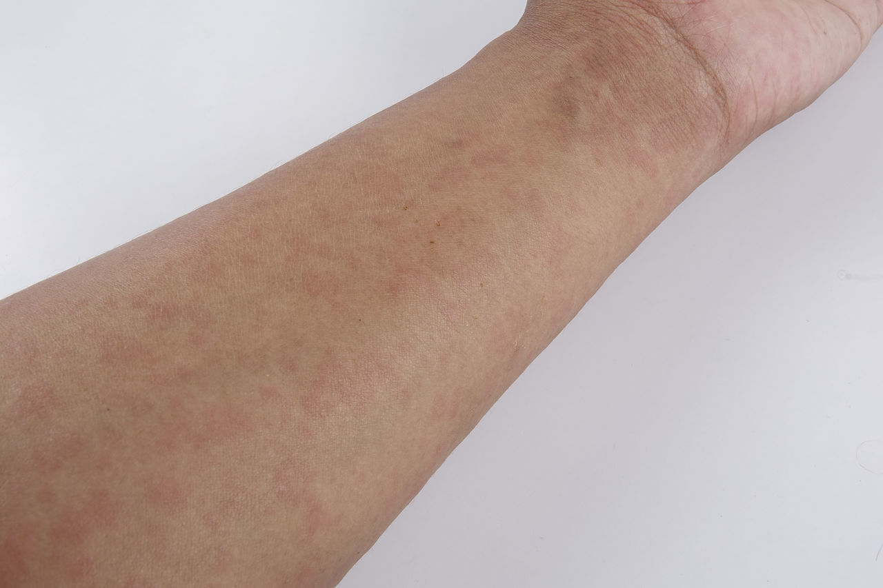 CLOSE-UP OF HUMAN HAND AGAINST WHITE BACKGROUND