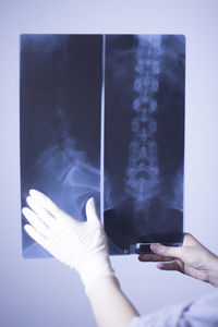 Cropped hand of doctor holding x-ray image against wall 