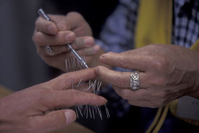 Cropped image of person getting acupuncture treatment