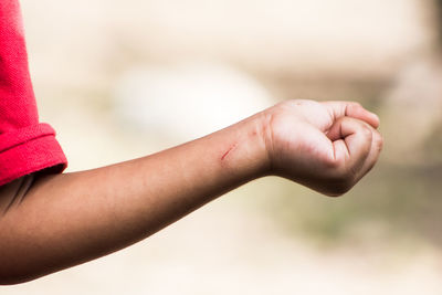 Cropped hand of boy with wound on wrist