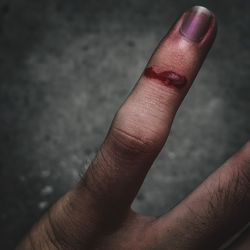 Cropped image of wounded finger outdoors