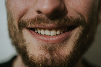 Close-up cropped portrait of nice bearded attractive cheerful cheery well-groomed guy. 