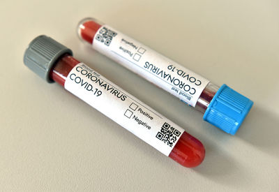 Coronavirus covid 19 infected positive result blood test sample