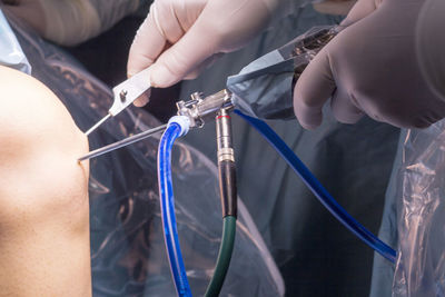 Midsection of doctors performing surgery on patient knee with equipment