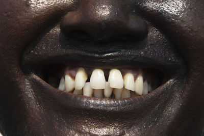 Close-up of human teeth
