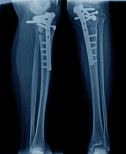 Full frame shot of x-ray