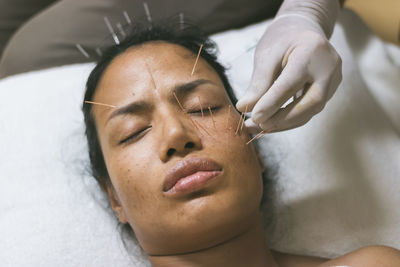 Therapist applying acupuncture needles on mature woman