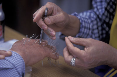 Cropped image of person getting acupuncture treatment