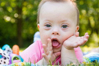 Close-up portrait of cute baby with down syndrome