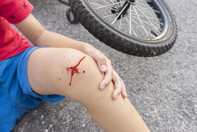 Midsection of child with wounded leg on road