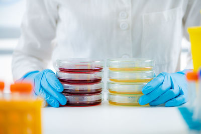 Microbiology lab work. stacks with petri dishes containing bacterial cultures.