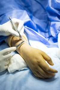 Doctors operating hand and wrist in hospital