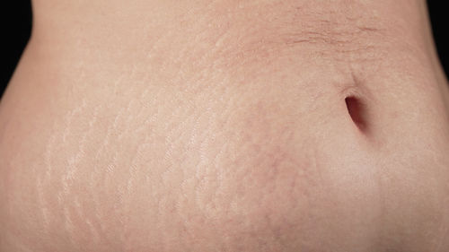 Close-up of human skin