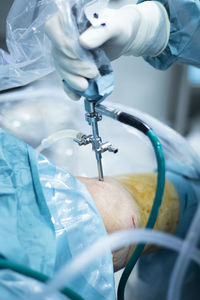 Cropped hand of doctor performing operation on patient knee in hospital