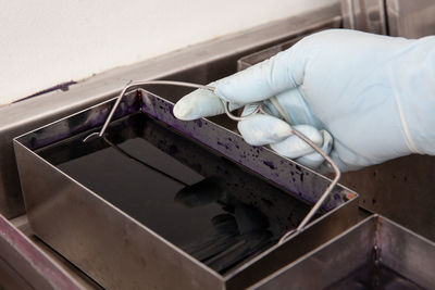 Scientist staining microscope slides for cytology studies in the laboratory.