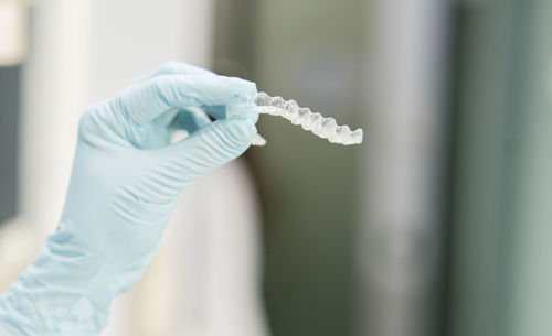 Dentist wearing protective gloves holding dental aligner at clinic