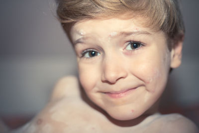 Portrait of boy infected with chickenpox 