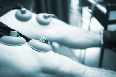 Close-up of medical equipment on patient legs at hospital