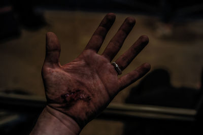 Cropped image of injured hand