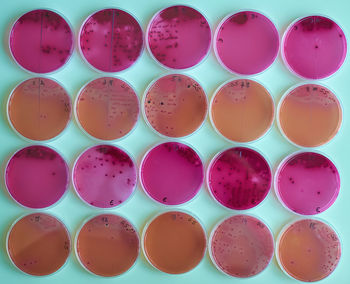 Agar plates with bacteria colonies in various petri dish