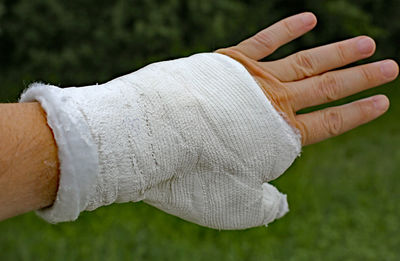 Cropped injured hand with plaster 