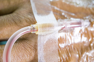 Patient with iv drip