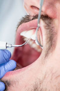 Cropped hand of dentist treating patient at clinic