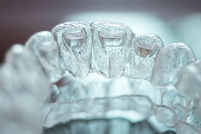 Close-up of dental aligners