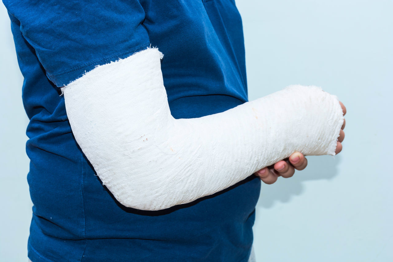 Arm in cast