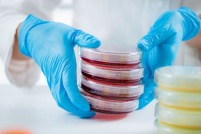 Microbiology lab. hands of a microbiologist, working with bacteria cultures