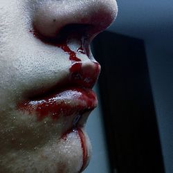 Close-up of person with bleeding nose